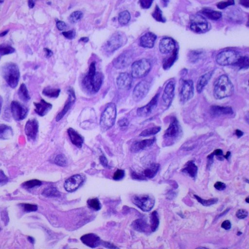 Multi-Cancer Detection